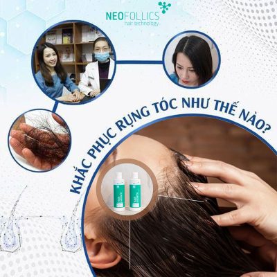Neofollics