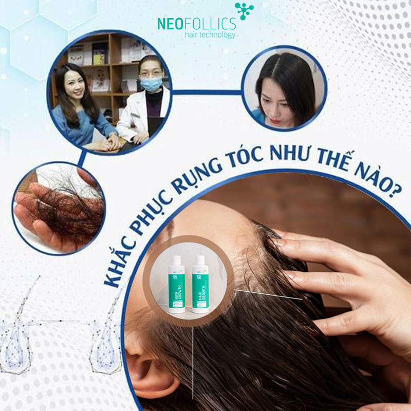 Neofollics