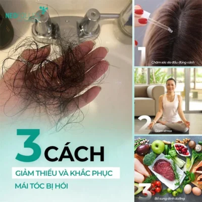 Cham-soc-toc