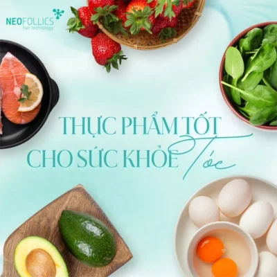 Thuc-pham-tot-cho-toc
