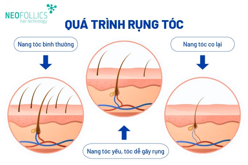 Rụng tóc là 1 phần trong chu kỳ phát triển của tóc, tóc mới sẽ mọc và thay thế những sợi đã rụng