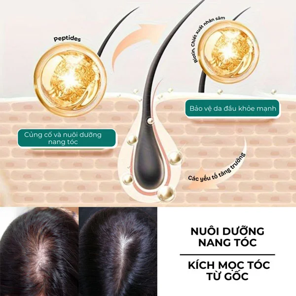 Dưỡng nang tóc là giải pháp từ gốc, ngừa rụng tóc và giúp tóc mọc lại khỏe mạnh