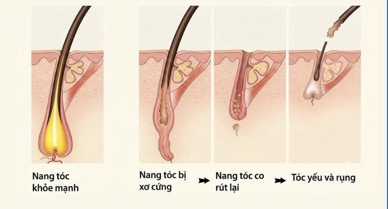 Nang-toc-suy-yeu