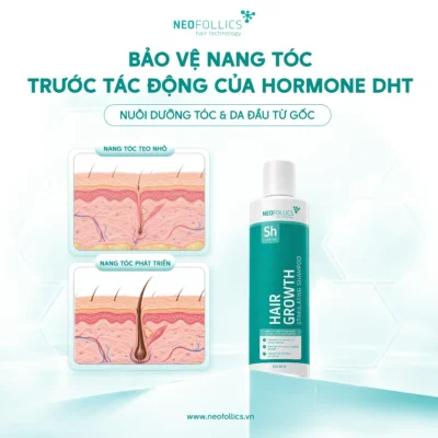 Neofollics-bao-ve-nang-toc-truoc-dht