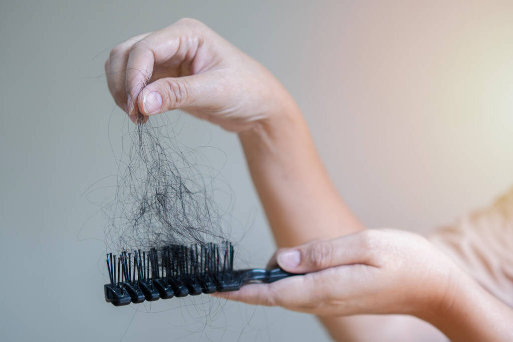 Woman Losing Hair On Hairbrush In Hand. Hair Loss Problem Concep